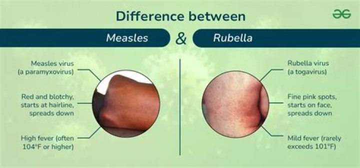 Are roseola and rubeola the same?