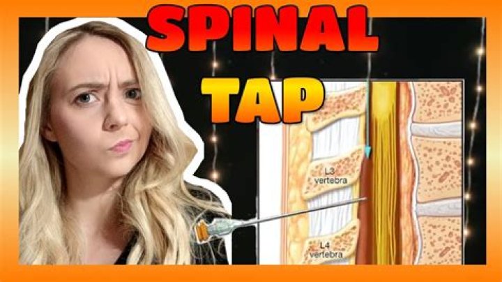 Are spinal taps painful?