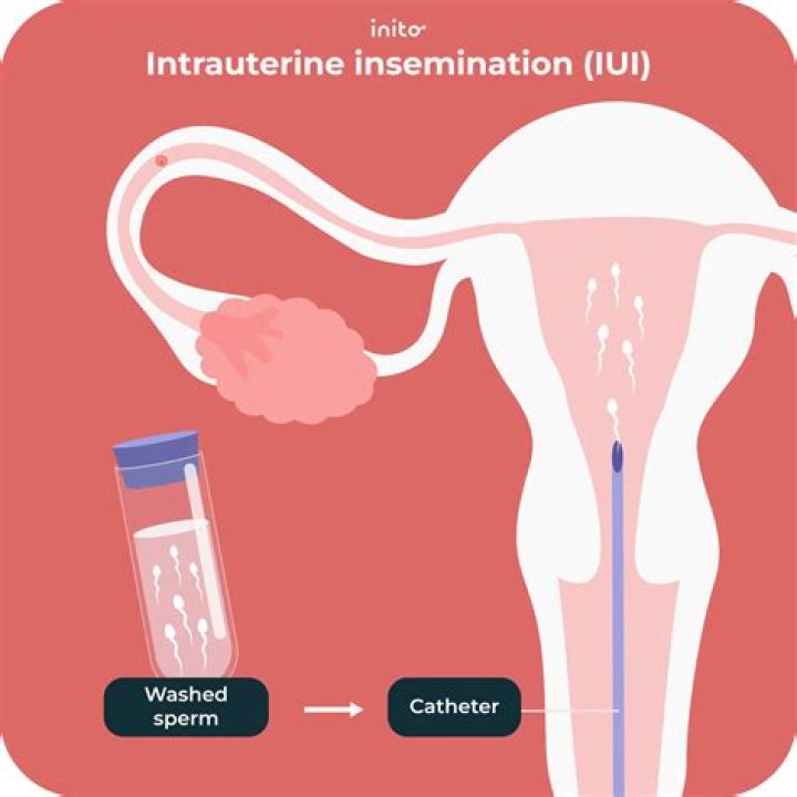 Can you artificially inseminate yourself?