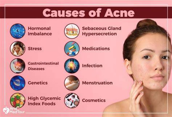 Do hydrogenated oils cause acne?