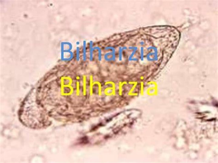 Does bilharzia cause infertility?