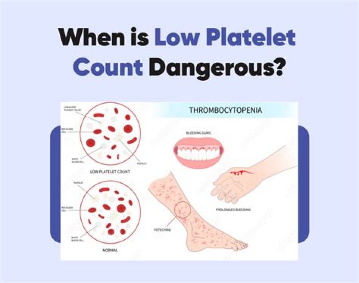 Does cow milk decrease platelet count?