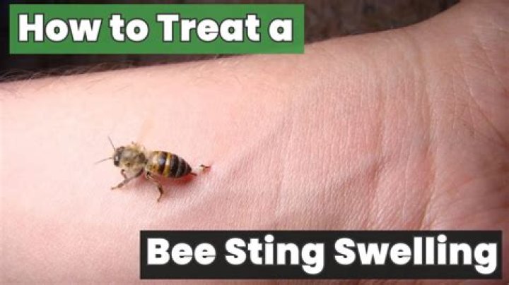 Does mud help bee stings?