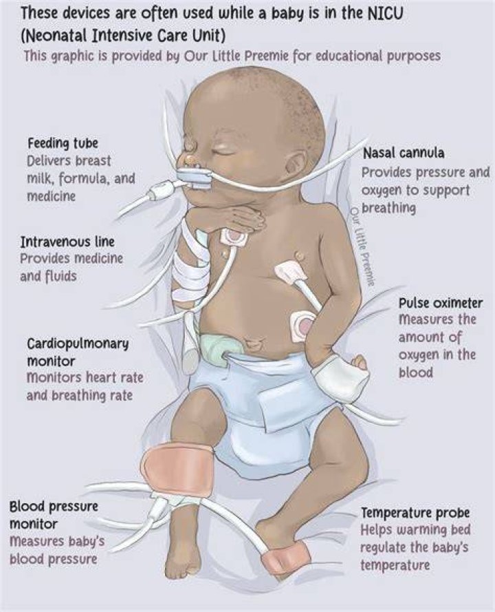 Does sibley have a nicu?