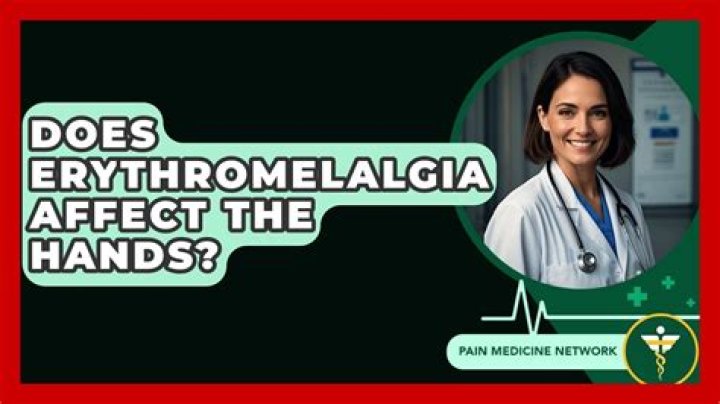 How does erythromelalgia spread?