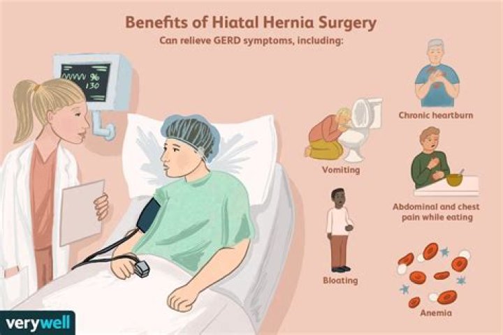 How long is hiatal hernia surgery?