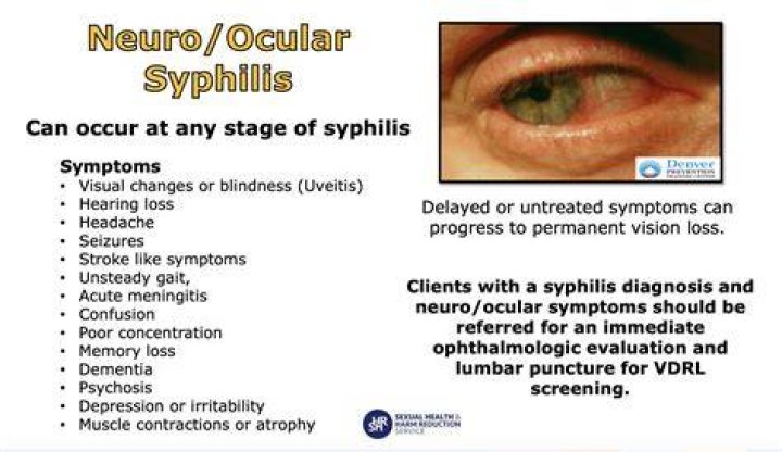 Is ocular syphilis neurosyphilis?