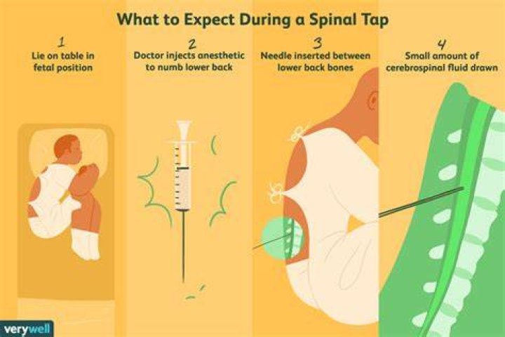 Is spinal tap painful?
