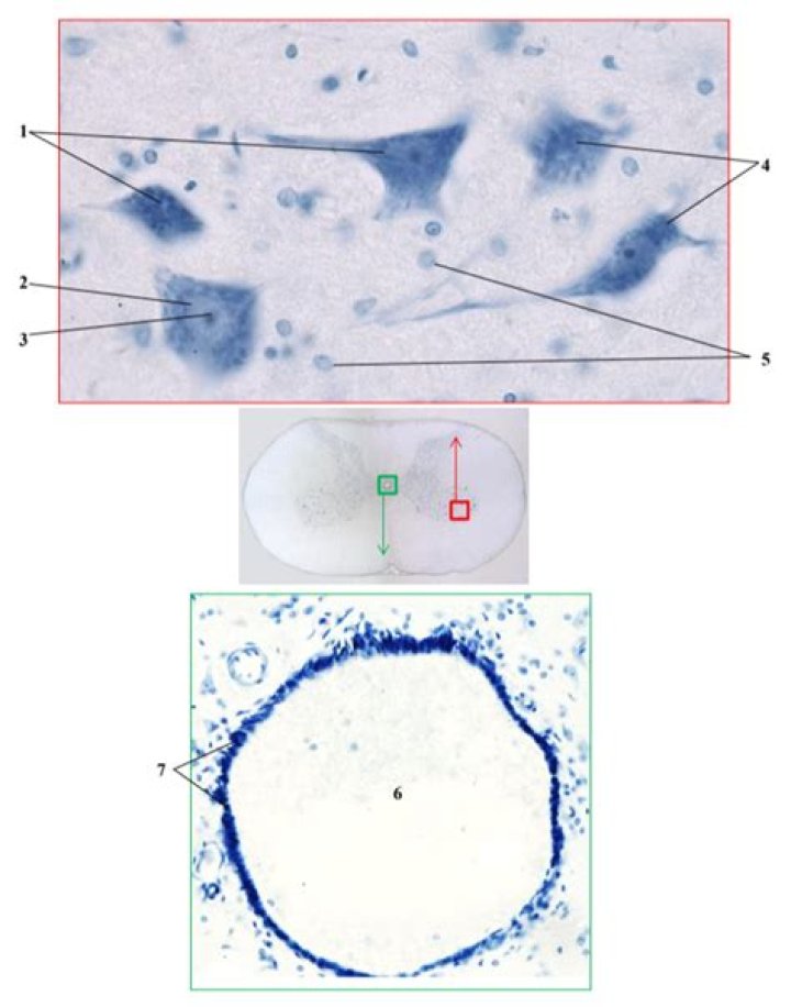 What does chromatophilic substance mean?