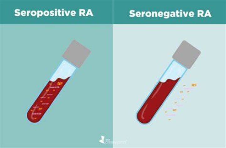 What does it mean if a person is seropositive?