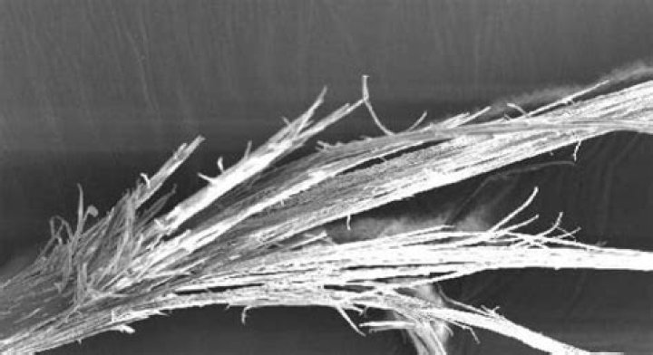 What is trichoptilosis milady?