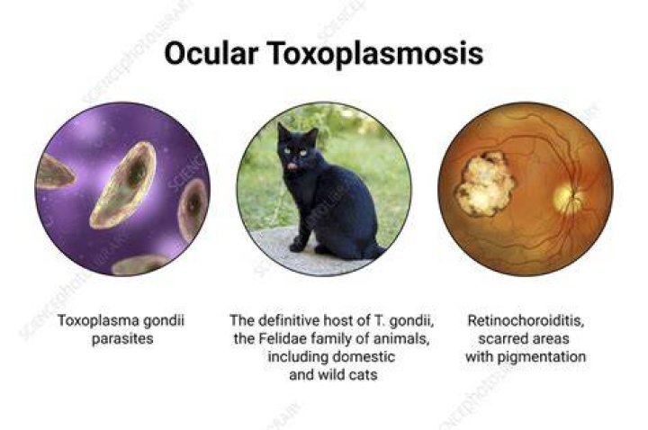 Where is toxoplasmosis found?
