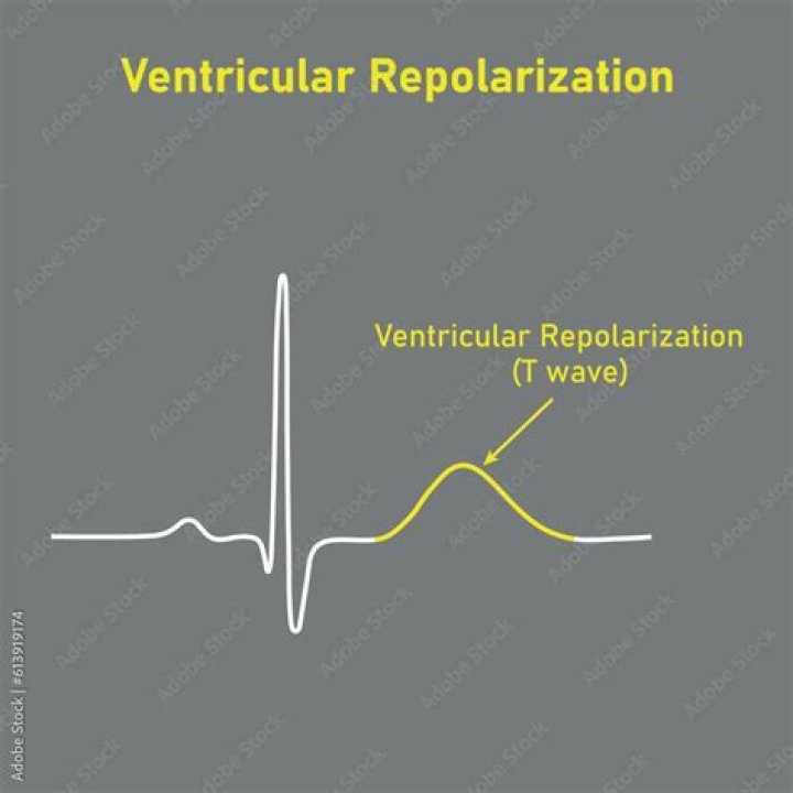 Which wave on the ecg represents ventricular repolarization?