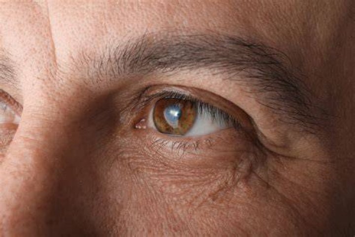 Will blepharospasm go away on its own?